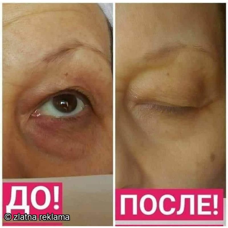Tibetski kompleks protiv otstranuvanje na podocnici
